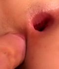 Anus lavage Anal ripping porn Anal emma